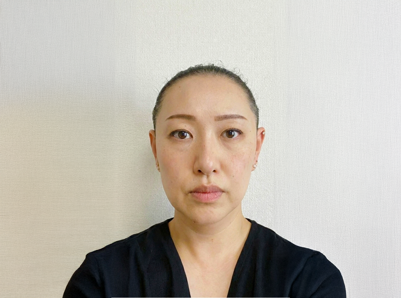 Case 03 After ─ 約1.5ヶ月後